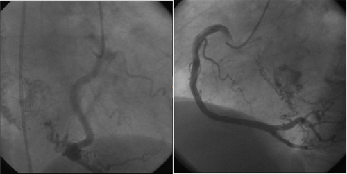 Nodal Artery